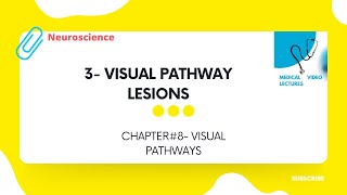 Visual pathway lesions | CHAPTER#8- VISUAL PATHWAYS.