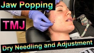 Dry Needling TMJ with Jaw and Neck Adjustment