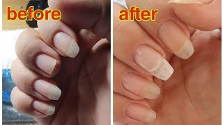 Gel nail extension/stilletto nail tips