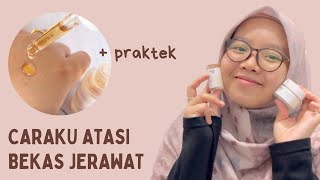 SKIN CARE UNTUK ATASI BEKAS JERAWAT - Whiteinc Bright Series #whiteinc #bekasjerawat