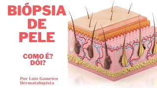 BIÓPSIA DE PELE: Como é? Dói? Por Luiz Gameiro, dermatologista