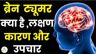 ब्रेन ट्यूमर के लक्षण, कारण और उपचार | Brain Tumor Ke Lakshan Kya Hota Hai | Brain Tumor Symptoms