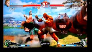 SSF4 Albofighter (Sagat) Vs Hugo 101 (Abel)