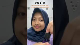 LIHAT INI SEBELUM BELI!! progress aku pakai lacoco dark spot essense #SHORTS