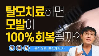 탈모치료 하면 모발이 100% 회복될까?