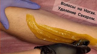 Волосы на Ногах. Депиляция Сахаром.