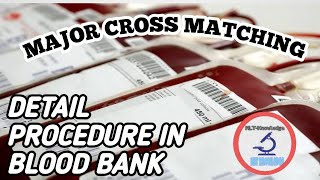 CROSS MATCHING_MAJOR CROSS MATCH _FULL DETAIL PROCEDURE IN BLOOD BANK