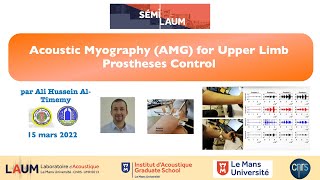 Semilaum - Acoustic myography for upper limb prostheses control, by A. H. Al-Timemy