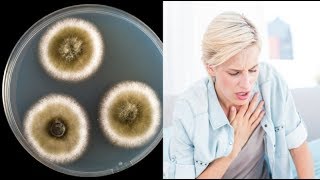 the 11 most commons symptoms of mold illness.. and A Great Natural Treatment for Mold Allergy