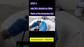 Gram Staining Method | Gram Positive Bacteria | Gram Negative Bacteria | Microbiology | Pathology