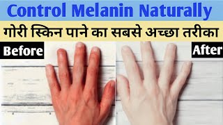 Melanin Kya hota hai in Hindi | Melanin kam karne ke Upay