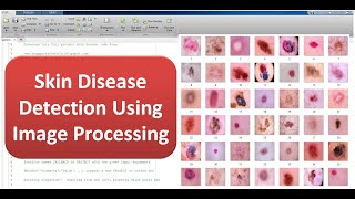 Skin Disease Detection Using Image Processing | Skin Disease Classification Using Matlab Project