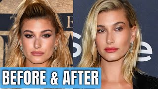 Hailey Bieber: Plastic Surgery