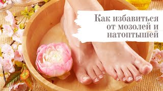 Как избавиться от сухих мозолей и натоптышей?