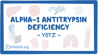 Alpha-1 antitrypsin deficiency (Year of the Zebra 2024)