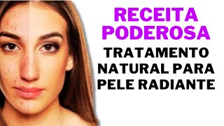 🌼Descubra o Segredo Adeus Melasma Rugas e Manchas na Pele🌼