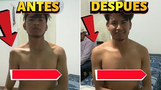 DISLOCACIÓN DE HOMBRO COMO ARREGLAR SIN DOLOR QUIROPRÁCTICO ARREGLA LUXACIÓN DE HOMBRO #chiropractic