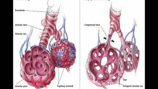 1-ALPHA 1 ANTITRYPSIN TEST