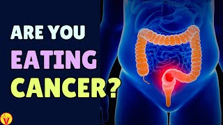 11 WORST Foods That Feed CANCER Cells (You're Eating Cancer!) | VisitJoy