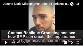 Jasons Scalp Micropigmentation Experience at Replique Grooming Brisbane