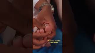 Unintentional asmr foot examination