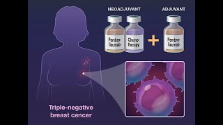 Overall Survival with Pembrolizumab in Breast Cancer | NEJM