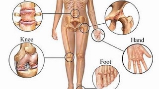 5 HERBS TO DISSOLVE URIC ACID CRYSTALS AND RELIEVE GOUT AND JOINT PAIN