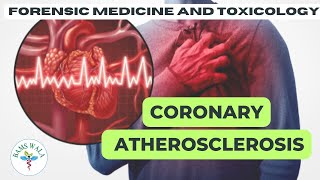 CORONARY ATHEROSCLEROSIS  ||  THANATOLOGY   ||  FORENSIC MEDICINE AND TOXICOLOGY  ||  BAMS WALA ||