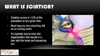 What are the Indications for Sciatica Surgery? From a Phoenix pain clinic (602) 507-6550