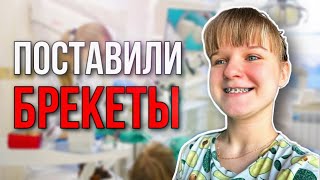 МНЕ ПОСТАВИЛИ БРЕКЕТЫ / МОИ ОЩУЩЕНИЯ / СКОЛЬКО СТОЯТ?!