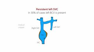 Persistent Left Superior Vena Cava (Left SVC) | Embryology and Clinical Anatomy