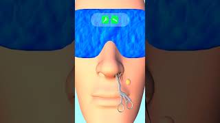 ✅ Face Clinic NEW Android iOS Casual Games All Levels Gameplay Walkthrough Max Level