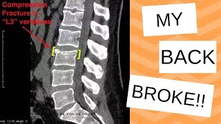 I BROKE MY BACK & DIDN'T KNOW IT! | Life Update