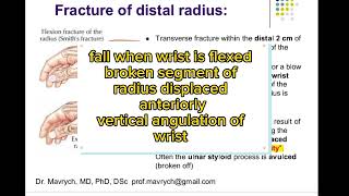 fractures of radius|anatomy shelf notes|fcps part-1 preparation forum|cpsp favorite BCQUES