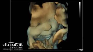 Scan of the Week: 35 week 3D/4D Baby Scan