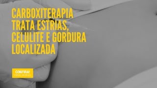 Carboxiterapia trata estrias, celulite e gordura localizada