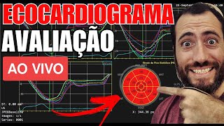 ECOCARDIOGRAMA, eco cardiograma, ecocardiograma com doppler, ecocardiograma transtorácico.