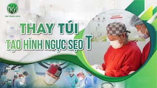 Thay Túi Tạo Hình Ngực Sẹo T | Bác Sĩ Ngô Mộng Hùng #ngomonghung