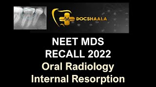 NEET MDS Recall 2022 |  Internal Resorption | Oral Radiology