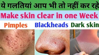 Skincare mistakes | Skin ko kaise saaf karen