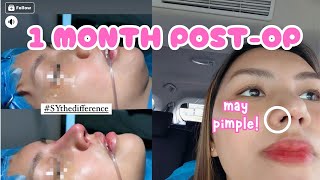 Gusto Magpa-RHINO? WATCH THIS | 1 Month Post-Op | Karenn C.