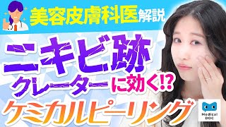 ニキビ肌が辛すぎる！！改善方法を専門医に聞いてみた【教えてドクター】