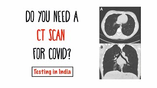 Do you need a CT scan for COVID? Testing in India