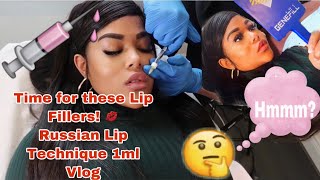 I GOT LIP FILLER | THE RUSSIAN TECHNIQUE 1ML | WHAT TO EXPECT VLOG💉💋