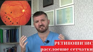 Ретиношизис сетчатки глаза 👁️ - причины, симптомы 😵, диагностика 🔬 и лечение 💉🔪