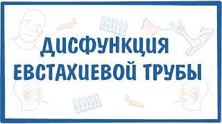 Дисфункция евстахиевой (слуховой) трубы (ДСТ) — причины, симптомы, патогенез, диагностика, лечение