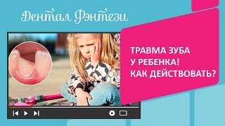 👉 🦷  Травма зуба у ребенка! Как действовать?