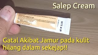 SALEP BENOSON - N CREAM || SANGAT MUJARAP UNTUK MENGOBATI GATAL PADA KULIT AKIBAT JAMUR