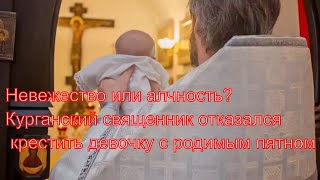 Курганский священник отказался крестить девочку с родимым пятном