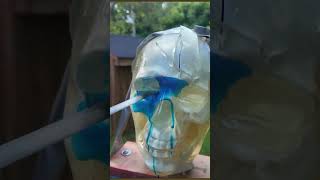 Surgical Procedure: Lobotomy - | - Tool: #Rapier